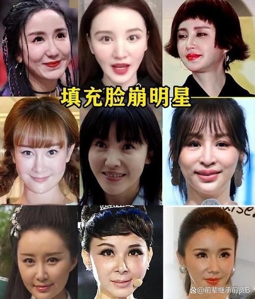 娱乐圈整容成功的案例_娱乐圈整容风潮深度调查_娱乐圈整容泛滥