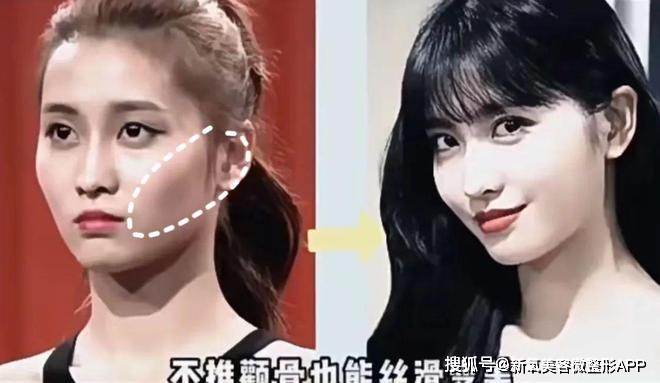 额头窄颧骨高的女明星_韩素希高颧骨审美_韩素希骨相美女