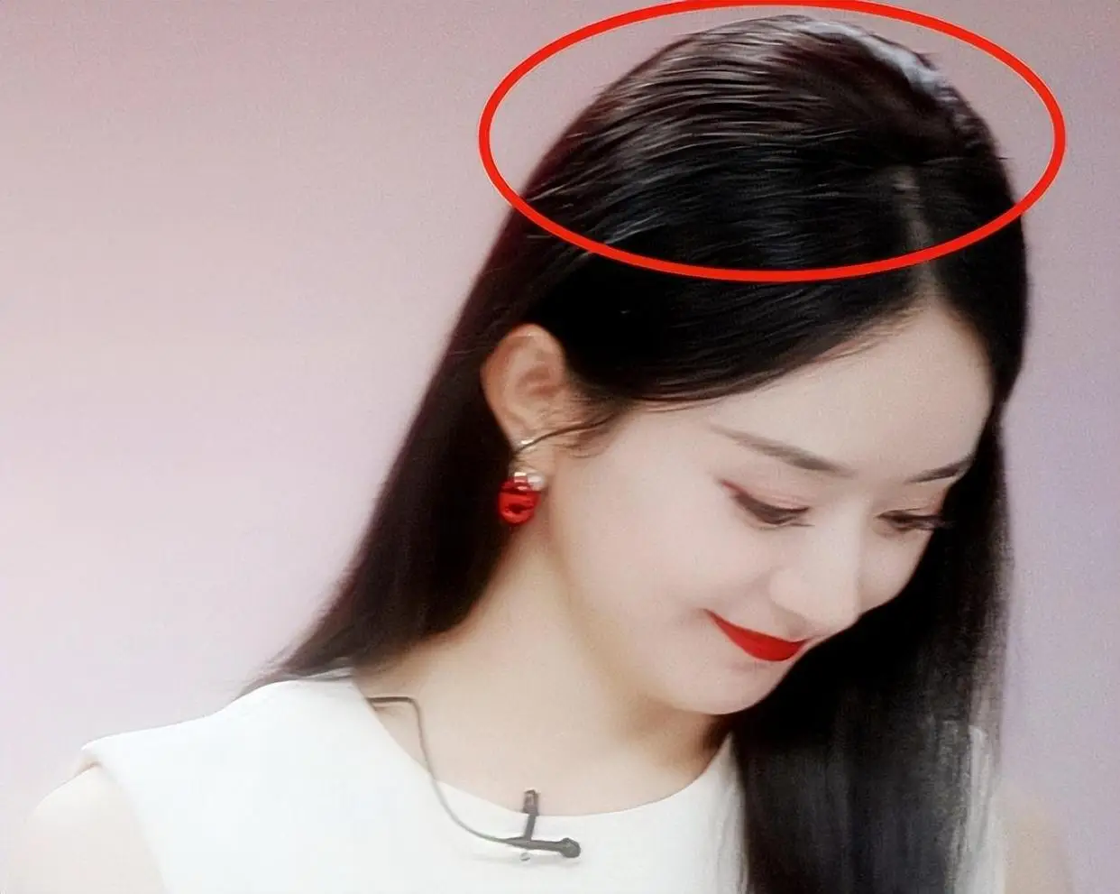 发量少的女明星有哪些_杨幂赵丽颖金晨假发片_女明星脱发严重